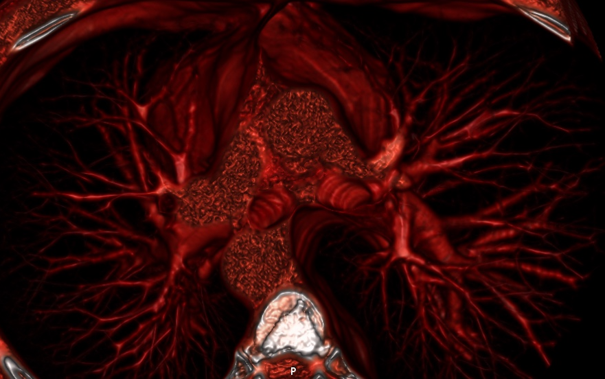 3d_image_of_my_heart